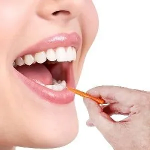 Soins des Gencives